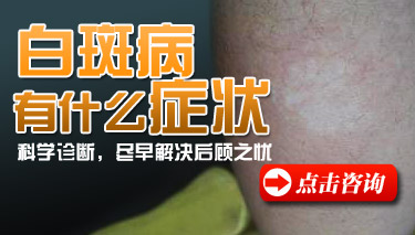 白癜风初期有什么样的表现