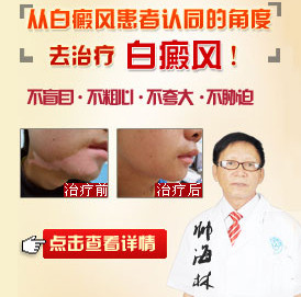 武汉白癜风医院.jpg